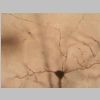 Neuronas Golgi 05.jpg